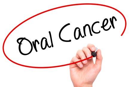 Oncologists warn against virus causing oral cancer