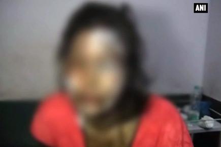 Man attacks wife with acid over infidelity suspicion