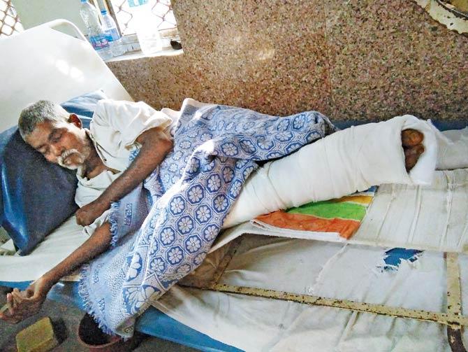 Babu Bhure is currently recuperating at the Rajawadi Hospital