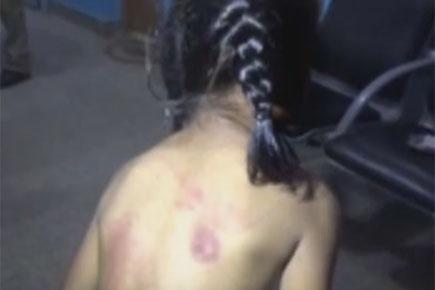 Bengaluru: Class 2 student beaten with belt by teacher for not doing homework