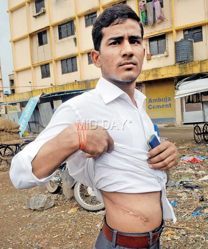 Sundar Singh Jadhav, who blew the lid off the racket after he was cheated out of one of his kidneys. Pics/Datta Kumbhar