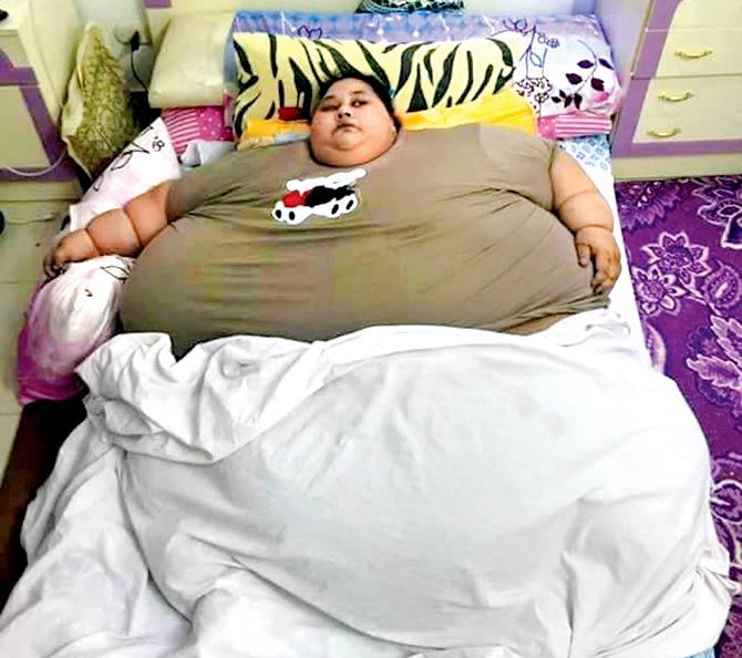 Iman Ahmad Abdulati has been obese since birth, but the condition has now become life-threatening