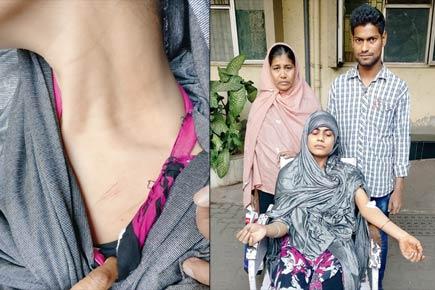 23-yr-old woman slashed over family dispute, Mumbai police refuses help
