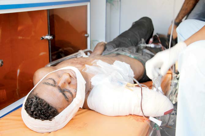 A wounded Yemeni receives treatment as he arrives at a hospital in Aden on Sunday. Pic/AFP