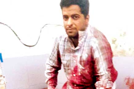 Bloodshed over iPhone 7! Thane man stabbed during cellphone sale
