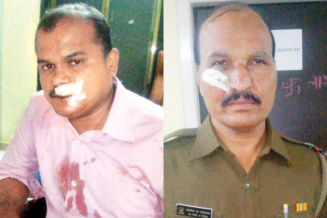Constable Sudarshan Nalavade and Assistant Sub-Inspector Chandramohan Gaikwad were helped by fellow passengers and the Dombivli GRP after they were injured by the stones