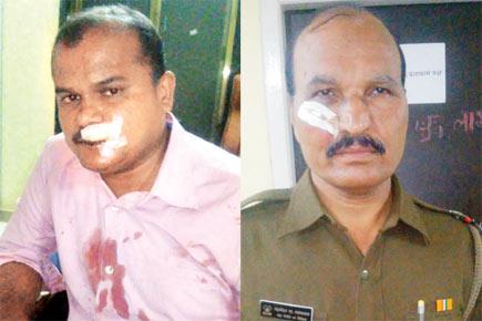 Two cops injured by stones pelted at trains near Mumbra
