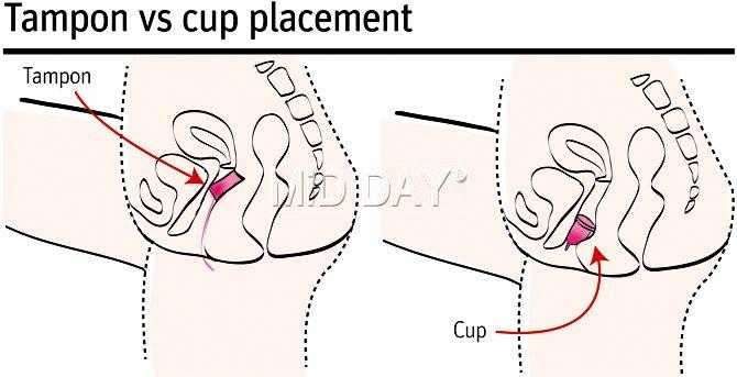 Tampon vs cup placement