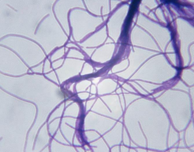 Microscopic Image of Bacillus Cereus Var. Mycoides