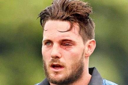 Nasty blow for Mitchell McClenaghan as ball smashes through grille