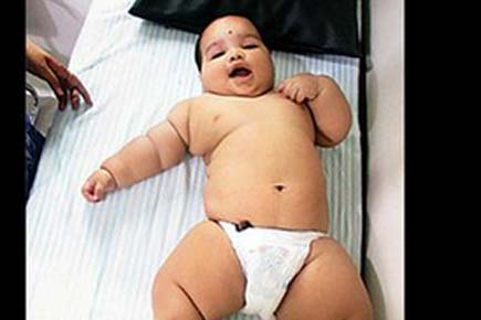 Mumbai: 18-month-old boy suffers from rare disorder, weighs 22 kgs