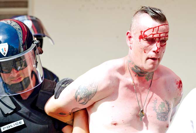 An injured England fan is taken into police custody in Marseille