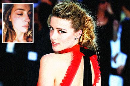 Did Johnny Depp suffocate Amber Heard?