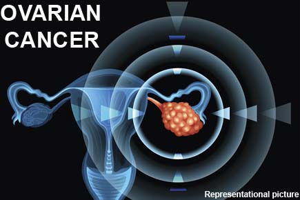 Health: Signs, symptoms of ovarian cancer that women shouldn't ignore