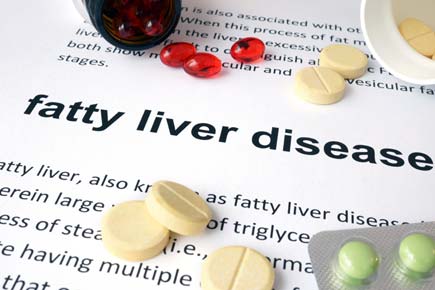 Fasting may help fight fatty liver disease