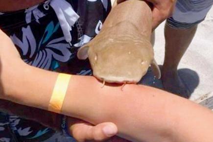 US woman rushed to hospital with shark stuck to arm
