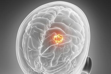 Tiny carrier can help treat brain tumour