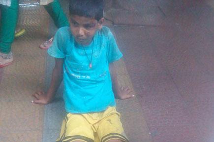 4 children hurt as a speeding car collides with a bike in Mumbai