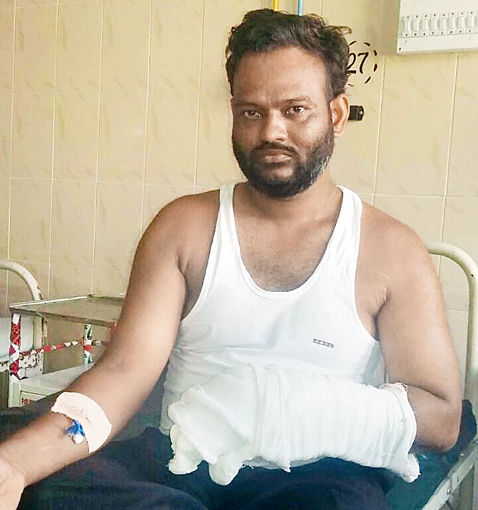 Auto rickshaw driver Bhagwan Appa Kengar, whose ring finger was sliced in the brawl. Pics/Rajesh Gupta
