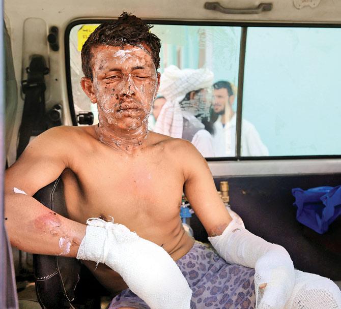 One of the injured after he was given first aid treatment. Pic/AFP