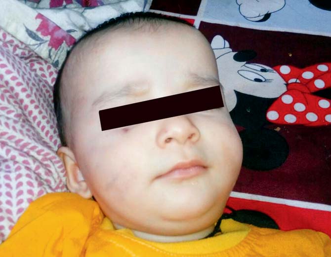 9-month-old Ritisha came home with bruises on her face and all over her body