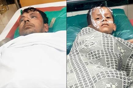 Mumbai crime: Sleeping Malad family wakes up to a nightmare acid attack