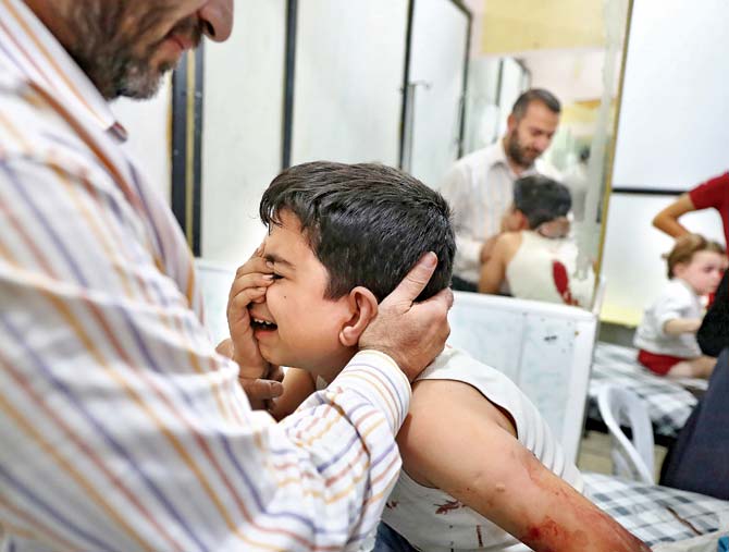 A wounded Syrian boy receives treatment at a make-shift hospital following reported government shelling on the rebel-held town of Douma. Pic/AFP