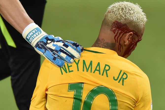 Neymar bleeds after being injured in the face