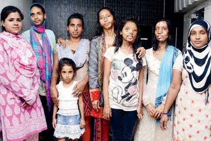 Acid attack survivors: Scarred, hurt, and looking for jobs