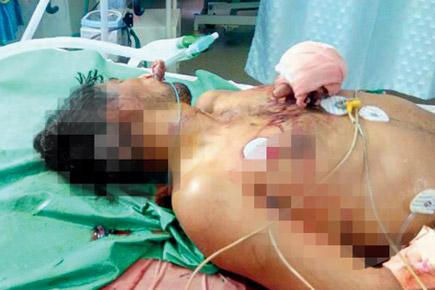 Mumbai Crime: Man attacked by wife's lover dies in hospital