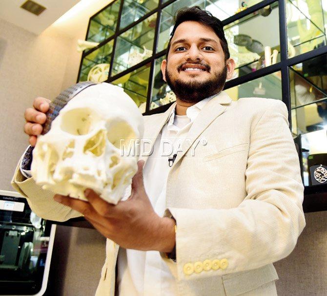 At the newly-opened Time to 3D cafe, Atit Kothari of Imaginarium shows us a 3D-printed skull of an actual patient with a craniectomy and a titanium implant. Pics/Sameerâu00c2u0080u00c2u0088Markande