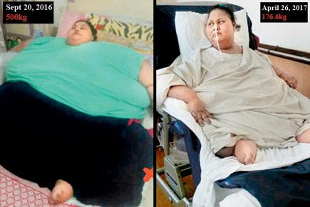 'I did my job honestly, Eman's bariatric surgery was a success'