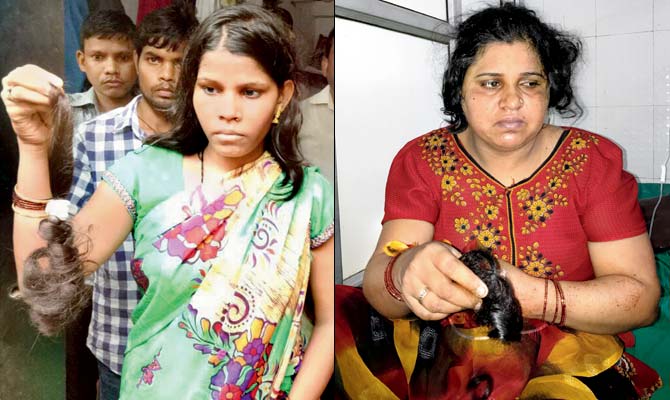 Binadevi Jaiswal (left) and Shabnam Banu had to be rushed to hospital after the shock of losing their hair. Pics/Hanif Patel