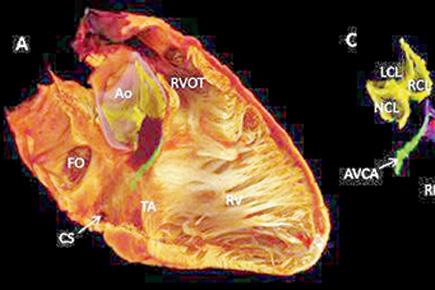 Scientists reveal source of human heartbeat in 3D