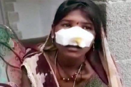 Woman nose slit off as she refuses to work as bonded labour