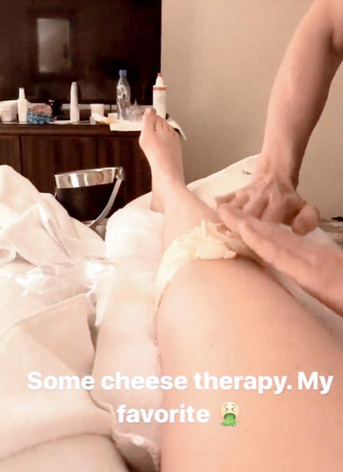 Lindsey Vonn cheese therapy