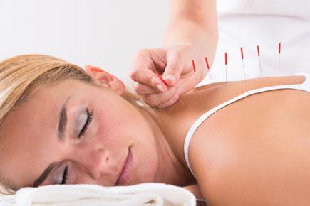 Health: Acupuncture can help reduce chronic pain, depression