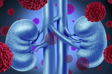 Australian researchers prevent progression of diabetic kidney disease