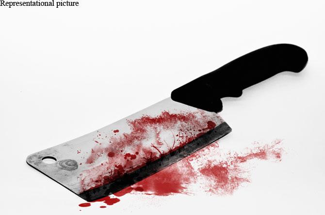  Man chops off 3-yr-old daughter