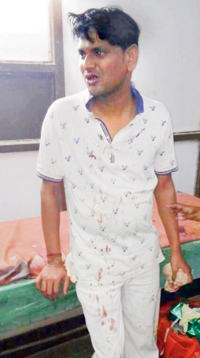 Mahesh Bhagat suffered two broken teeth and a fractured upper jaw after the incident