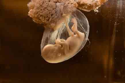 Unbelievable! Baby born from a 16-year-old frozen embryo