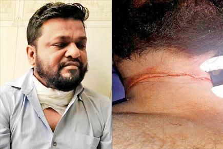 Mumbai: Stray manjha cuts through man's neck on Western Express Highway
