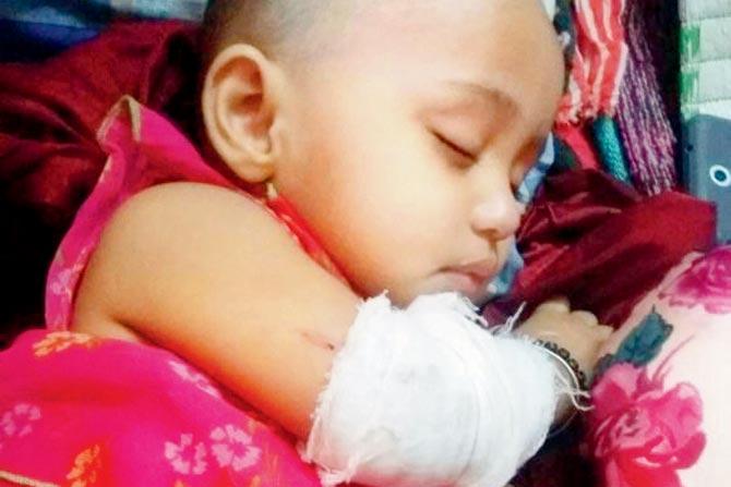 Almeera received five stitches on her left hand, and is currently recuperating at KEM Hospital