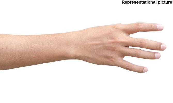 Artificial skin