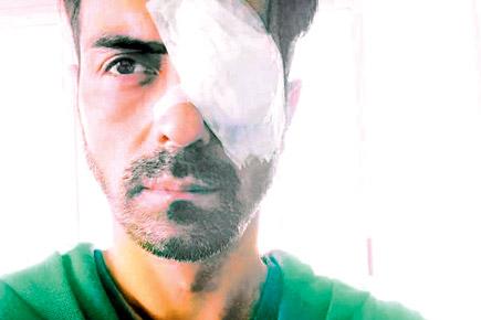 Arjun Rampal 'disoriented' after eye injury