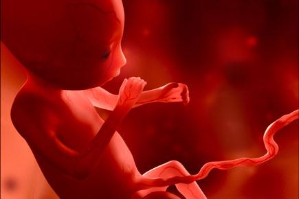 Supreme Court nod to terminate 24-week-old foetus citing medical reasons