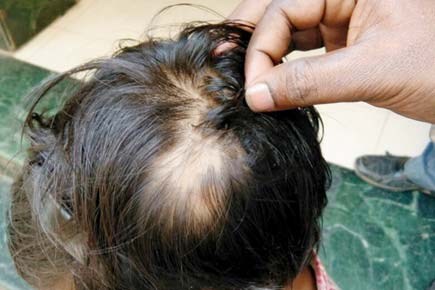 Thane: Teacher uproots 7-year-old's hair over late fees