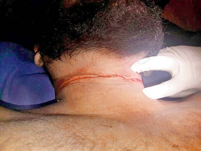 Rizwan Khan was on his way to Andheri, when the manjha dug into two layers of the skin on his neck