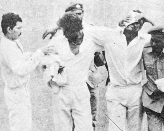 Yajurvindra Singh being helped off the ground after getting hit on his nose in the 1979 Madras Test