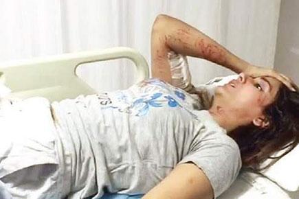 Actress hospitalised after being attacked by stray dogs in Mumbai